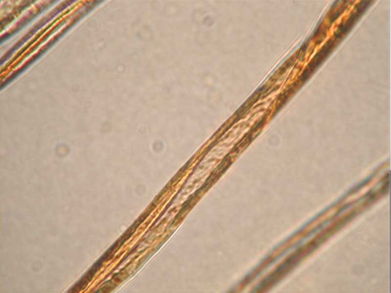 染色后纖維側(cè)面觀(guān)察(棉)